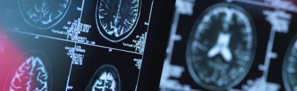 Brain scans of possible disease or damage in clinic