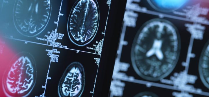 Brain scans of possible disease or damage in clinic